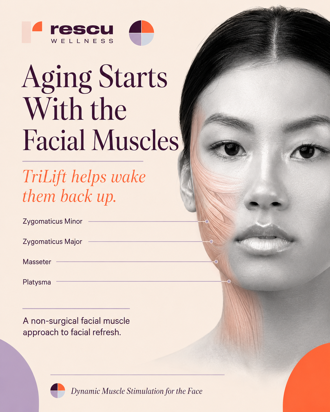 RF Microneedling collagen remodeling in the dermis