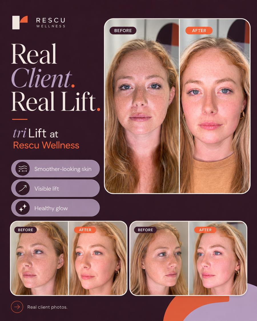 TriLift real client at Rescu Wellness